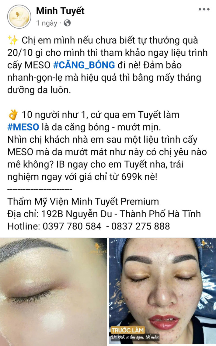 Cơ sở thẩm mỹ Minh Tuyết quảng cáo dịch vụ tiêm Meso dù không được phép triển khai kỹ thuật này