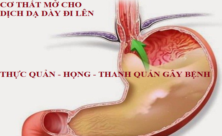 Biến chứng có thể gặp phải nếu không điều trị