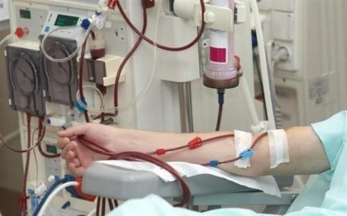 Mối nguy hiểm từ “trào lưu” lọc máu ngừa đột quỵ, tim mạch