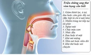 Những điều cần biết về sự nguy hiểm của ung thư vòm họng