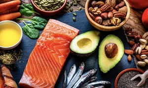 10 thực phẩm giàu omega-3 tốt cho sức khỏe và trí não