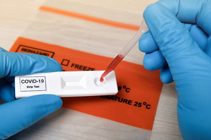 Yêu cầu doanh nghiệp báo cáo khả năng cung ứng, giá test xét nghiệm và chịu trách nhiệm về tính chính xác. Ảnh nguồn: ITN Yêu cầu doanh nghiệp báo cáo khẩn khả năng cung ứng, giá test xét nghiệm và chịu trách nhiệm về tính chính xác